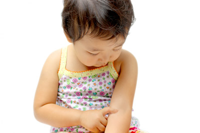 アトピー性皮膚炎のイメージ写真