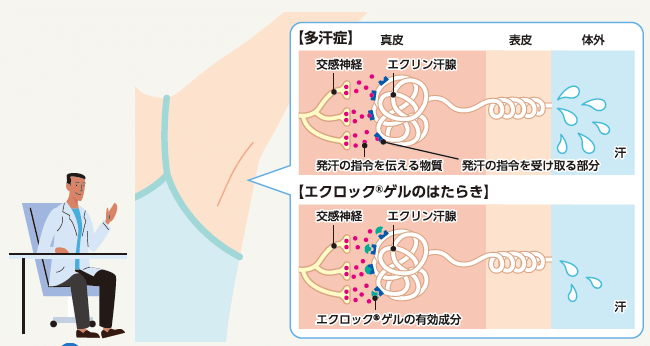 エクロックゲル5%のはたらきのイラスト