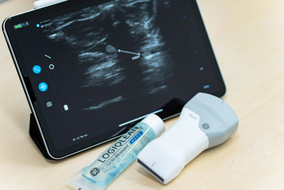 超音波診断装置